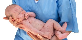 EXCLUSIV Epidemie pe strazile Bucurestiului, tacere complice la Ministerul Sanatatii